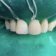 recenzie vancea dent Odete F. recenzie vancea dent Odete F.